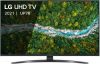 LG 75UP78006LB 4K LED TV online kopen